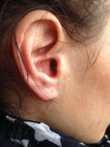 Set "STEREO+" (without Phone) + Micro earpiece "PICO" photo 2
